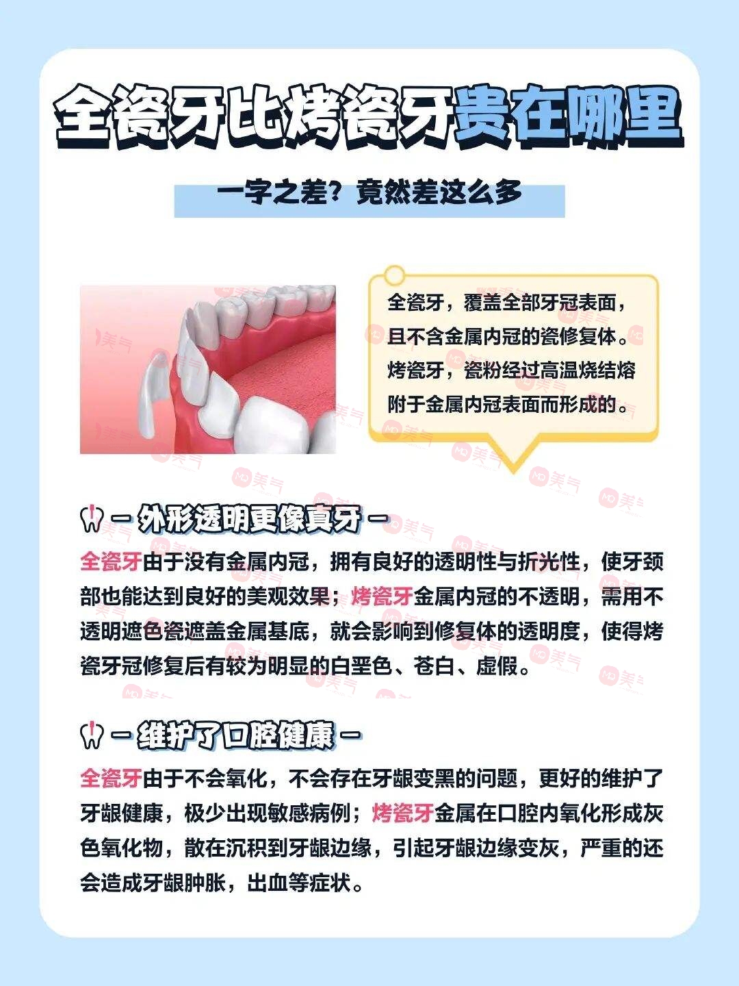 廣州全瓷牙價(jià)格多少？2023費(fèi)用明細(xì)-全瓷牙優(yōu)勢(shì)、注意事項(xiàng)附上