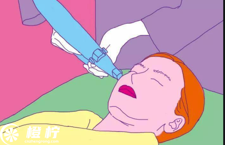 廣州激光祛斑醫(yī)院排名前五|哪里好？高人氣口碑機(jī)構(gòu)推薦