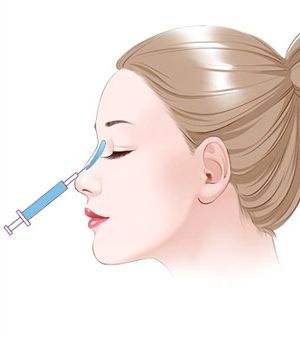 注射隆鼻要多少錢？項(xiàng)目介紹和優(yōu)缺點(diǎn)盤點(diǎn)