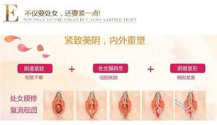 處女膜修復(fù) 處女膜修復(fù)