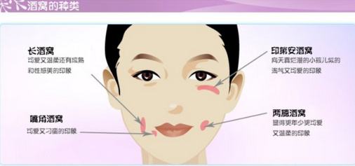 酒窩成型術項目介紹,價格是多少？附案例展示