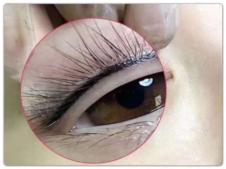 種睫毛要多少錢？效果怎么樣？簡介和優(yōu)缺點(diǎn)盤點(diǎn)