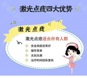 激光點痣 激光點痣