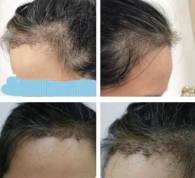 杭州格萊美醫(yī)療美容醫(yī)院怎么樣？