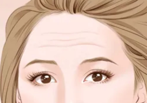 哈爾濱醫(yī)科大學附屬第二醫(yī)院拉皮除皺多少錢？附除皺案例以及介紹~