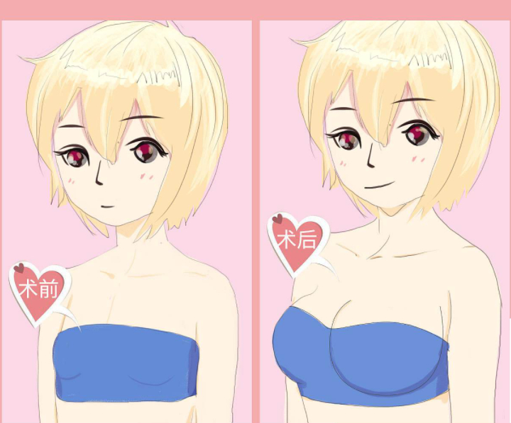 北醫(yī)三院美容整形科怎么樣？醫(yī)院信息＋案例分享