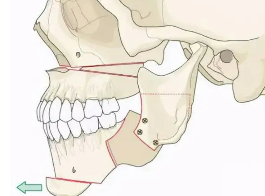 溫州藝星整形醫(yī)院怎么樣？科室概況、案例反饋