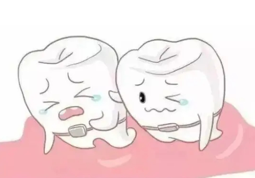 武漢協(xié)和醫(yī)院正畸多少錢？內(nèi)附正畸案例展示|牙齒矯正科普