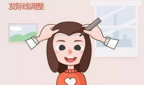 廣州青逸植發(fā)醫(yī)院靠譜嗎？醫(yī)生詳情及頭發(fā)種植案例