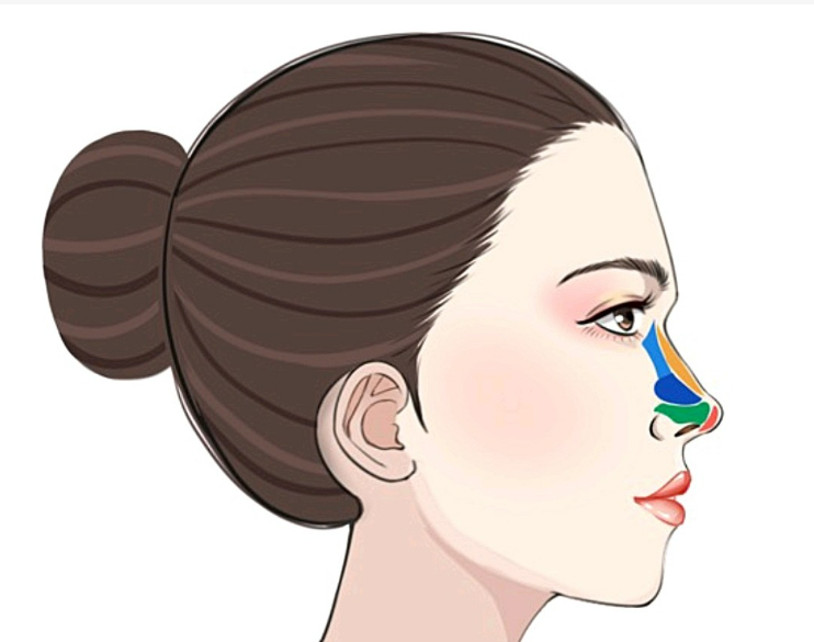 寧波薇琳整形醫(yī)院靠譜嗎？假體隆鼻案例口碑+收費標準