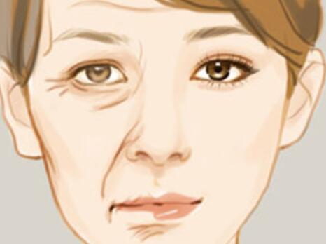 哈醫(yī)大二院除皺價格多少錢 哈醫(yī)大二院除皺價格多少錢