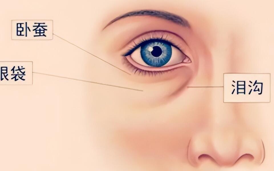 脂肪填充淚溝