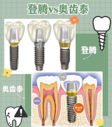 種植牙哪一種品牌最好？介紹10個比較有名的品牌