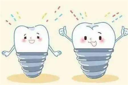 了解2024年種牙價格！一顆牙齒種植所需費用大揭秘！