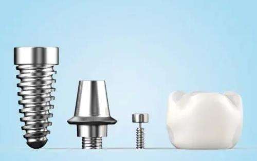 種植牙哪一種品牌最好？介紹10個比較有名的品牌