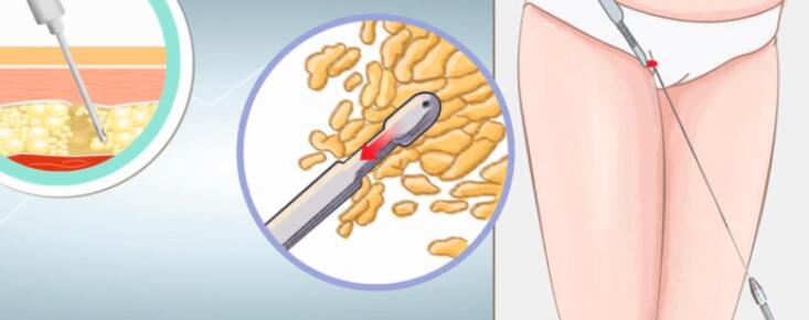 QQ截圖20230410161122.jpg QQ截圖20230410161122.jpg