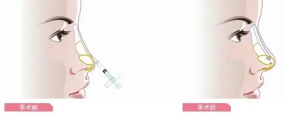 QQ截圖20230510111703.jpg QQ截圖20230510111703.jpg