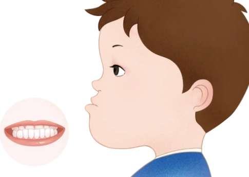 牙齒地包天怎么辦？可以采取的措施比較多，比如佩戴矯正器