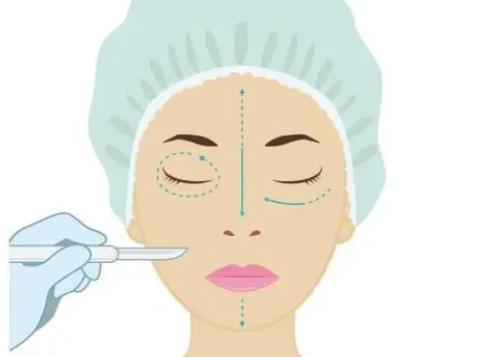 面部填充dm03.jpg 面部填充dm03.jpg