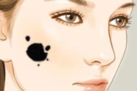祛痣動漫09.jpg 祛痣動漫09.jpg