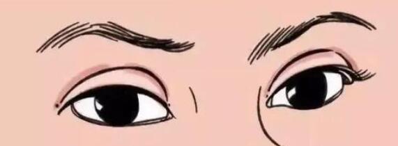 雙眼皮動漫22.jpg 雙眼皮動漫22.jpg