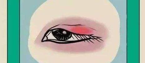 雙眼皮動(dòng)漫34.jpg 雙眼皮動(dòng)漫34.jpg