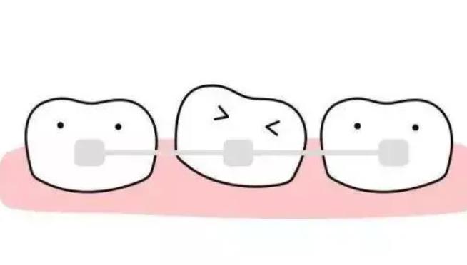 牙齒矯正dm11.jpg 牙齒矯正dm11.jpg