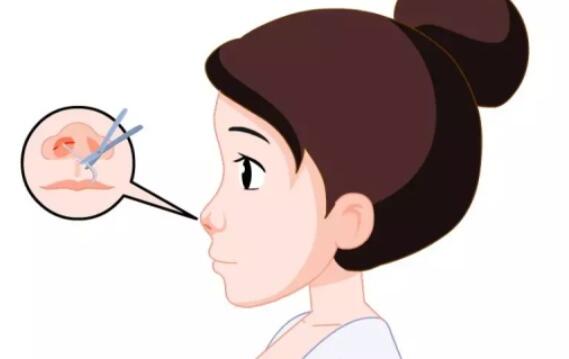 隆鼻動漫.jpg 隆鼻動漫.jpg