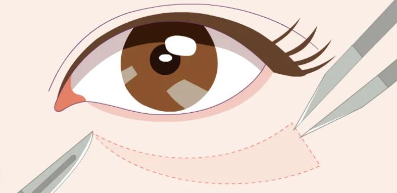 去眼袋動(dòng)漫12.jpg 去眼袋動(dòng)漫12.jpg