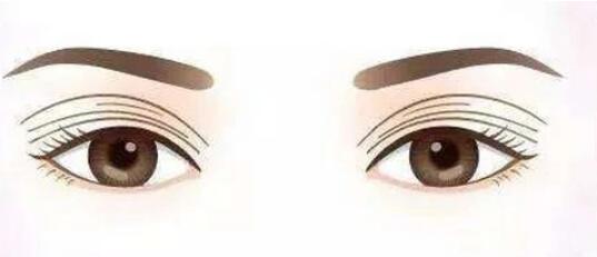 雙眼皮動漫14.jpg 雙眼皮動漫14.jpg