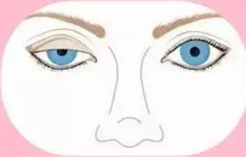 上瞼下垂矯正.jpg 上瞼下垂矯正.jpg