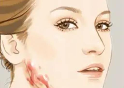 疤痕額頭dm02.jpg 疤痕額頭dm02.jpg