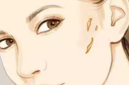 疤痕動漫02.jpg 疤痕動漫02.jpg