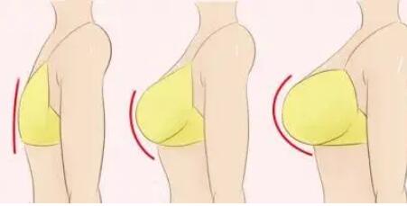 隆胸動(dòng)漫43.jpg 隆胸動(dòng)漫43.jpg