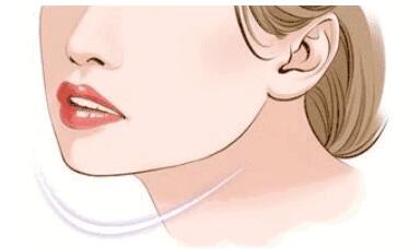 下頜角動(dòng)漫27.jpg 下頜角動(dòng)漫27.jpg