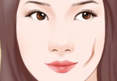 疤痕hg2.jpg 疤痕hg2.jpg