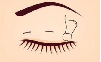 雙眼皮動漫25.jpg 雙眼皮動漫25.jpg