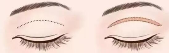 雙眼皮動(dòng)漫20.jpg 雙眼皮動(dòng)漫20.jpg