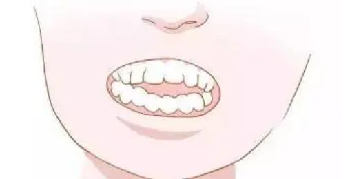 牙齒矯正hg24.jpg 牙齒矯正hg24.jpg