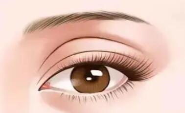 雙眼皮動(dòng)漫76.jpg 雙眼皮動(dòng)漫76.jpg