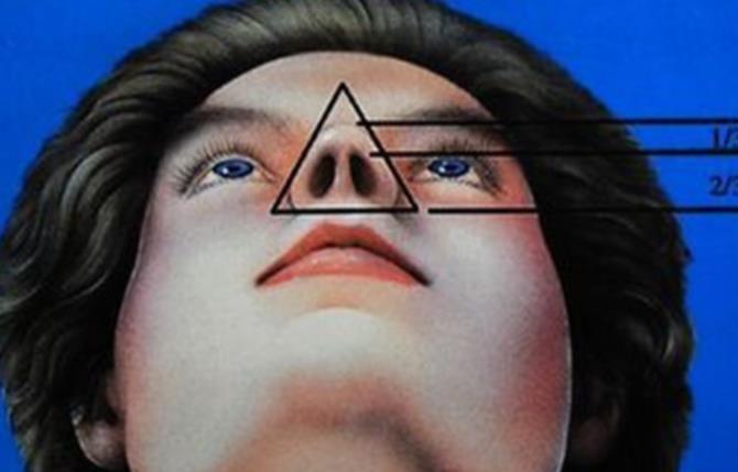 鼻翼變窄h(huán)3.jpg 鼻翼變窄h(huán)3.jpg