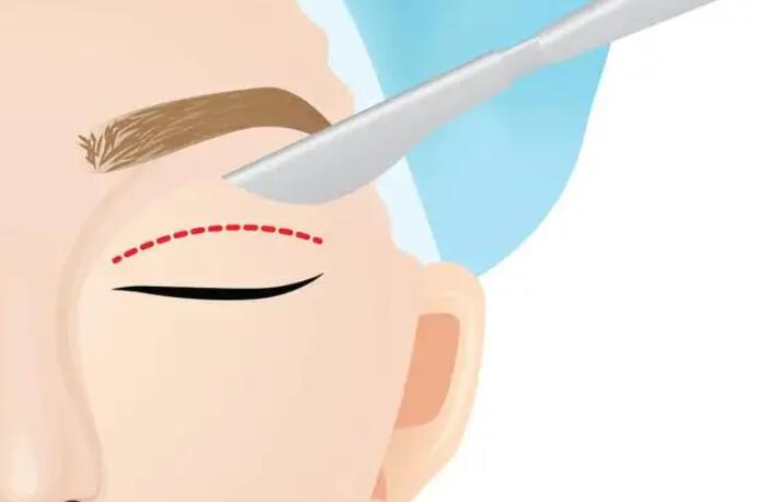 雙眼皮動(dòng)漫55.jpg 雙眼皮動(dòng)漫55.jpg