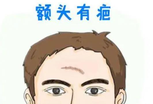 疤痕額頭dm01.jpg 疤痕額頭dm01.jpg