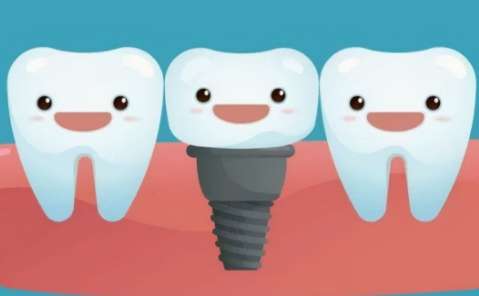 種牙的材料及價格怎么樣？其價格一般會在4500元到2萬元之間