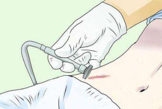 祛疤動漫09.jpg 祛疤動漫09.jpg