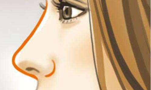 l隆鼻t0.jpg l隆鼻t0.jpg