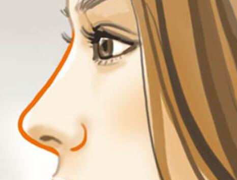 隆鼻動漫02.jpg 隆鼻動漫02.jpg