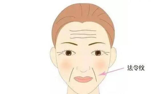 法令紋動漫02.jpg 法令紋動漫02.jpg