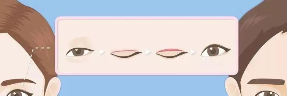 雙眼皮dm55.jpg 雙眼皮dm55.jpg