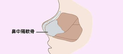 隆鼻動(dòng)漫25.jpg 隆鼻動(dòng)漫25.jpg
